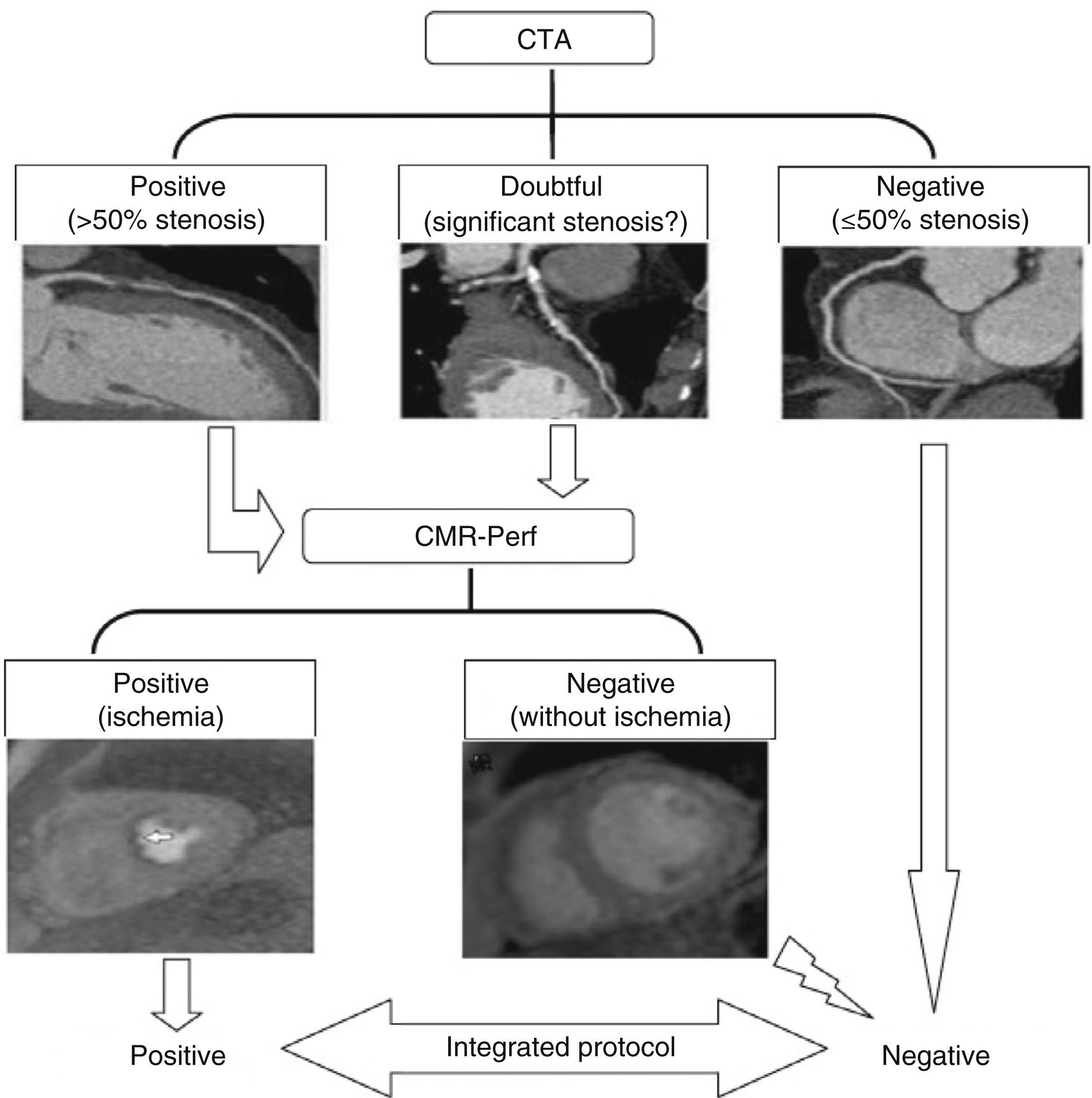Noninvasive anatomical and functional assessment of coronary artery ...