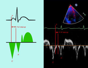Measurement of the time from the onset of the P wave on the ECG to the beginning of the A′ wave on tissue Doppler imaging (PA′-TDI interval).