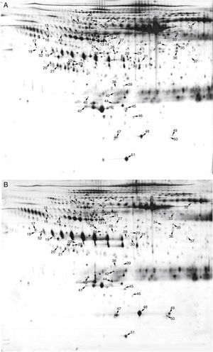 Two-dimensional electrophoresis analysis of the serum exosome proteome. Gels were visualized by silver staining. Arrows indicate differentially expressed proteins in Kawasaki disease (KD) patients with coronary artery dilatation (CAD) and healthy controls. Spot numbers correspond to proteins in Table 1. (A) Healthy controls; (B) KD patients with CAD.