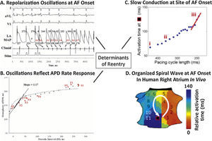 Initiating mechanisms for human atrial fibrillation. (A) Electrograms of ectopy (S2) initiating AF. (B) Steep relationship of atrial repolarization to preceding interbeat interval (APD vs DI) enables S2 to produce repolarization oscillations. (C) Conduction also shows drastic slowing imminently preceding AF onset (iii, red slope). (D) Conduction slowing and dispersion of repolarization cause formation of a counter-clockwise spiral on the atrial shell, that initiated AF and was conserved for multiple AF initiations and diverse triggers in this patient.