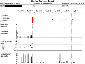 Graphical view of treated ventricular tachycardia/ventricular fibrillation episodes/day (top) and non-sustained ventricular tachycardia episodes/day (bottom). The y-axis represents the number of episodes and the x-axis represents time in months. The vertical downward red arrow indicates the visit when dronedarone was started, in mid-October 2015.