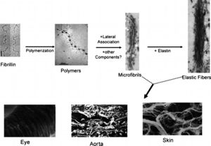 Schematic representation of the major steps underlying the assembly of microfibrils and elastic fibers (top) with three examples of tissue-specific networks (bottom) (adapted from Ramirez et al.30).