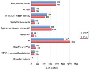 Distribution of procedures by type of ablation in 2017 and 2018. AF: atrial fibrillation; AFl: atrial flutter; AP: accessory pathway; AVNRT: atrioventricular nodal reentrant tachycardia; AVRT: atrioventricular reentrant tachycardia; PVCs: premature ventricular contractions; VF: ventricular fibrillation; VT: ventricular tachycardia; WPW: Wolff-Parkinson-White syndrome.