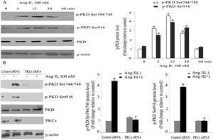 Angiotensin II (Ang II) stimulates PKCɛ-dependent PKD phosphorylation in cardiomyocytes. (A) Cardiomyocytes were stimulated with Ang II for various times. Phosphorylated PKD (p-PKD) protein levels were examined using Western blotting and normalized to the total levels of PKD. Ang II (100 nM, 0 min) was used as the control. Data are shown as mean ± standard error of the mean (SEM) of four separate experiments. *p<0.05 vs. controls; (B) cells were treated without or with Ang II (100 nM) and in the absence or presence of PKCɛ siRNA. Western blots (n=4) showed the phosphorylation of PKD and expression levels of PKCɛ and β-actin. Data are shown as mean ± SEM. *p<0.05 vs. control siRNA+ Ang II(-); #p<0.05 vs. control siRNA+Ang II(+).