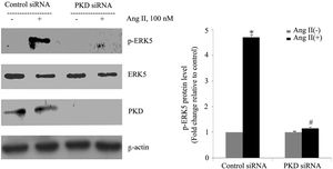 PKD specifically mediates angiotensin II (Ang II)-induced ERK5 phosphorylation. Cardiomyocytes were transfected with control or PKD small interfering RNA (siRNA), and then stimulated with Ang II. Phosphorylated ERK5 protein levels were examined using Western blotting and normalized to the total levels of ERK5. Data are shown as mean ± standard error of the mean of four separate experiments. *p<0.05 vs. control siRNA+ Ang II(-); #p<0.05 vs. control siRNA+Ang II(+).