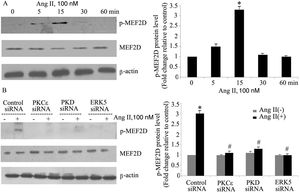 The PKCɛ/PKD/ERK5 pathway is involved in angiotensin II (Ang II)-induced MEF2D activation. (A) Cardiomyocytes were stimulated with Ang II for different times (0-60 min). Phosphorylated MEF2D protein levels were examined using Western blotting and normalized to the total levels of MEF2D. Data are shown as the mean ± standard error of the mean of four separate experiments. *p<0.05 vs. control without Ang II stimulation; (B) cardiomyocytes were treated without or with Ang II (100 nM) and in the absence or presence of PKCɛ, PKD or ERK5 small interfering RNA (siRNA). *p<0.05 vs. control siRNA+ Ang II(-); #p<0.05 vs. control siRNA+Ang II(+).