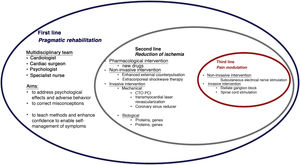Approach and therapeutic options for refractory angina. CTO: chronic total occlusion; PCI: percutaneous coronary intervention.