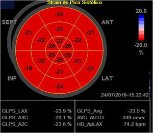 Global longitudinal strain calculation using two-dimensional speckle tracking, using AFI. In the figure, the global longitudinal strain of the left ventricle obtained was 23.5% in a patient with Type 1 diabetes. GLPS_Avg: mean global longitudinal peak systolic strain; AVC: aortic valve closure time; HR: heart rate; AFI: automated imaging function.