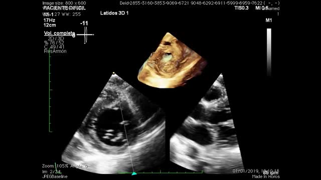 https://ars.els-cdn.com/content/image/1-s2.0-S2174204921003159-mmc5.mp4