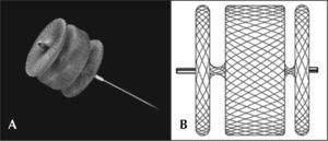 – In A, Amplatzer® Vascular Plug II. In B, illustrative drawing showing the three discs and the device’s nitinol mesh.