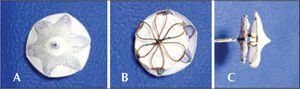 – Details of the new version of the CARDIA prosthesis. A, Left surface of the disc. Note the metal completely covered by the Ivalon™ sponges. B, Surface of the right disc, which is smaller than the left one, with the nitinol loops and the central capture pin clearly visible. C, Prosthesis profile view, held by the bioptome.