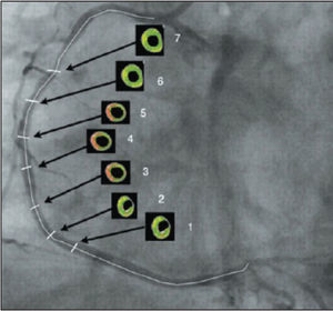 – Schematic example of cross-sections in the images generated by Virtual Histology®.