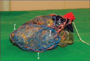 – The model shows the origin of the anterior interventricular branch of the left coronary artery and marginal branches, both directed towards the apex. (a, anterior interventricular branch; b, vena cardiaca magna; c, left coronary artery; d, marginal branches)