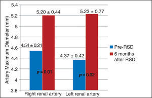 Change in the maximum diameters of the renal arteries, 6 months after percutaneous renal sympathetic denervation (RSD).