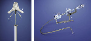 MitraClipTM Device (left) and its delivery system (right). Each arm (A) of the clip is 4mm wide and 8mm long. The clips (B) are used to hold the cusps of the mitral valve in the clip arms. The steerable catheter is a 24 F and has shunters (C and E) to guide and correctly position the clip. The stabilizer (D) is used to support the MitraClipTM delivery system.