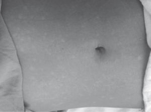 Aspecto de islas blancas en un mar rojo.