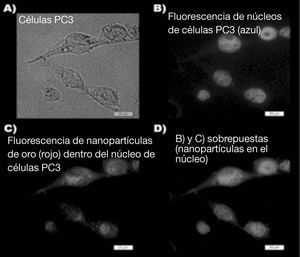 Representación del campo (40X) de células PC3 tratadas con AuNP-Tat-BN. A) En contraste de fase, B) núcleo de las células teñido con Hoechst, C) detección la autoflorescencia emitida por las AuNP´s después de ser excitadas a 530nm, y D) fusión de imagen nuclear y de fluorescencia.