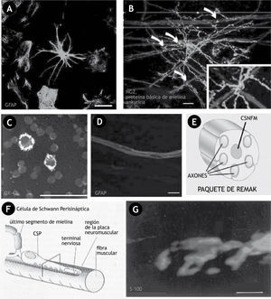 Ilustración de diferentes tipos de células gliales en el SNC A) Microfotografía de astrocitos in vitro extendiendo sus procesos celulares, los cuales establecen un íntimo contacto con las neuronas, con los oligodendrocitos, con la barrera hematoencefálica y con otros astrocitos; los astrocitos no forman mielina y en este caso fue marcado mediante inmunocitoquímica con GFAP (una proteína específica de astrocitos). B) Sinantocitos en contacto con los nodos de Ranvier, fotografías de microscopia confocal del velum medular anterior del cerebro de rata, la tripleinmunohistoquímica muestra el marcaje específico de los sinantocitos contra la proteína condroitina proteoglicanos sulfato NG2 (en verde), en rojo contra la proteína básica de mielina y en azul contra la proteína marcadora de los nodos de Ranvier Ankyrina. Las flechas curvadas muestran múltiples procesos celulares de los sinantocitos en contacto con los nodos de Ranvier que se aprecian con más detalle en el acercamiento. C) Microfotografía de células de la microglía, estas células responden a una lesión del SNC mediando interacciones neuroinmunes, marcada con anti-OX-42 una proteína especifica de células microgliales. D) Microfografía de una célula de Schwann que no forma mielina, marcada con GFAP una proteína especifica de este tipo de células. E) Esquema de un paquete de Remak. F) Esquema de una célula de Schwann perisináptica (CSP), que cubre con finos procesos celulares los axones de la terminal nerviosa en la placa neuromuscular. G) Microfotografía de una CSP marcada mediante inmunohistoquímica con el anticuerpo S-100 (una proteína específica (especifica) de células de Schwann) y revelado con FITC (en verde). Barras, 20μm (A, y G), 10 μm en (B y D), 25μm en (C). Adaptada de Castonguay et al.44; Rochon et al.66; Butt et al.67; Liu et al.68; Lara-Ramírez et al.69; Salzer70.