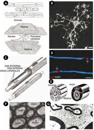 Ilustración de los dos principales tipos de células gliales que forman mielina tanto en el SNC como en el SNP A) Esquema de un oligodendrocito, el cual como se puede observar cubre con la vaina de mielina varios axones de manera simultánea, las vainas de mielina se extienden de un núcleo externo mediante procesos celulares (arriba). En el esquema inferior, se puede observar la cubierta trapezoidal de la vaina de mielina haciendo una representación gráfica extendida de la membrana celular del oligodendrocito. B) Microfotografía de un oligodendrocito en cultivo marcado con anti-04 (proteína específica de oligodendrocitos) mediante inmunocitoquímica. C) En el SNP, las células encargadas de formar mielina son las CSFM que cubren con la vaina de mielina un sólo axón en una relación 1 a 1, aunque a lo largo de un axón cubierto por mielina se pueden encontrar miles de CSFM. En un corte longitudinal de la CSFM y el axón se puede observar la peculiar forma de la cubierta de mielina que genera una asa interna en estrecho contacto con el axón, una asa externa que queda en contacto con la lámina basal (LB) y las asas laterales que son formadas hacia la parte final de la de la célula, como producto del enrollamiento de la membrana plasmática. D) Microfotografía de células de Schwann que forman mielina de rata, las cuales muestran un internodo marcado mediante inmunohistoquímica con el anticuerpo MBP en azul y un nodo de ranvier (flechas) marcado en rojo de manera específica con la proteína ezrina (EZR). E) Modelos de diferentes axones que conforman un nervio periférico maduro en (a) axones amielínicos envueltos por una CSNFM y en (b) un axón mielinizado por una CSFM, donde se pueden observar las capas de mielina formadas por el enrollamiento de la membrana plasmática de la CSFM sobre el axón y por otra parte el núcleo en el citoplasma abaxonal de la célula. Este modelo es muy similar al encontrado para los oligodendrocitos del SNC, el núcleo del oligodendrocito es totalmente externo. F) Microfotografía electrónica de oligodendrocitos del nervio óptico de ratón, mostrando axones mielinizados, en la cual no se puede apreciar que los oligodendrocitos se encuentren cubiertos por LB. G) Microfotografía electrónica de un corte transversal de un ganglio de la raíz dorsal de gato (X13,000), el cual muestra una unidad de axones no mielinizados (figura de pato), envueltos por una CSNFM, los axones pueden estar agrupados (*) o de manera solitaria (x). Los axones marcados por un círculo están cubiertos por lámina basal (LB), sin ser cubiertos por una CSNFM y embebidos dentro del espacio del endoneuro (EE). En esta imagen también se pueden apreciar axones mielinizados (M), distinguiéndose de manera evidente por las gruesas capas de mielina (negro) de las CSFM y también se puede observar el prominente núcleo hacia el citoplasma exterior de la CSFM, conocido como citoplasma abaxonal. En la parte más externa de estos axones mielinzados se puede apreciar que se encuentran cubiertos de LB. Barras, 25 μm B); 12.5 μm en D) y 200nm en F). Adaptada de Hirano y Llena43, 1995; Berthold y Rydmark44, Melendez-Vasquez et al.45.