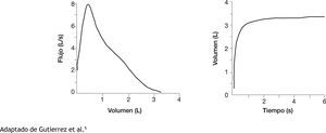 Gráficas de flujo-volumen y volumen-tiempo en espirometría Adaptado de Gutierrez et al.5