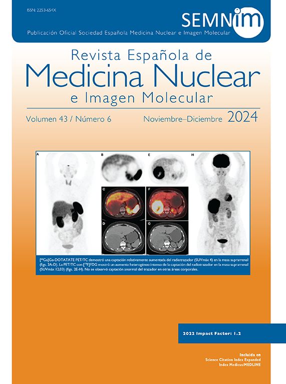 Guía rápida de procedimiento de la PET/TC con PSMA | Revista Española ...