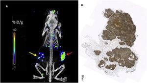 A: PET image with the LEM 2/15 antibody labeled with zirconium [89Zr]-DFO-LEM 2/15 of a mouse with a subcutaneous implant of glioblastoma cells that express MT1-MMP (red arrow) and a subcutaneous implant of cells that do not express MT1-MMP as a control (yellow arrow). B: Immunohistochemistry with the specific LEM 2/15 antibody versus MT1-MMP showing elevated expression of the antigen.