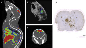 Orthotopic implant of glioblastoma cells showing uptake of the specific immunoPET probe in (A) sagittal slice; (B) representation in 3D of the brain with the tumor; and (C) axial slice. (D) histological slice showing elevated expression of the antigen in the glioblastoma.