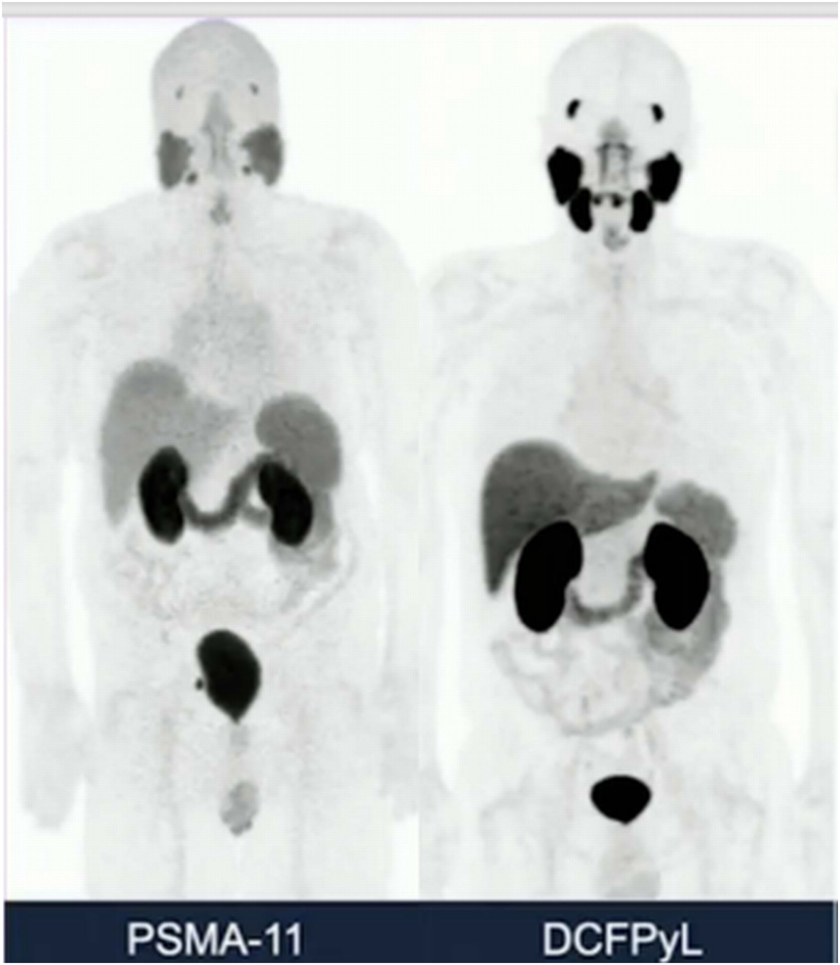 18F-DCFPyL PET/CT guidelines | Revista Española de Medicina Nuclear e ...