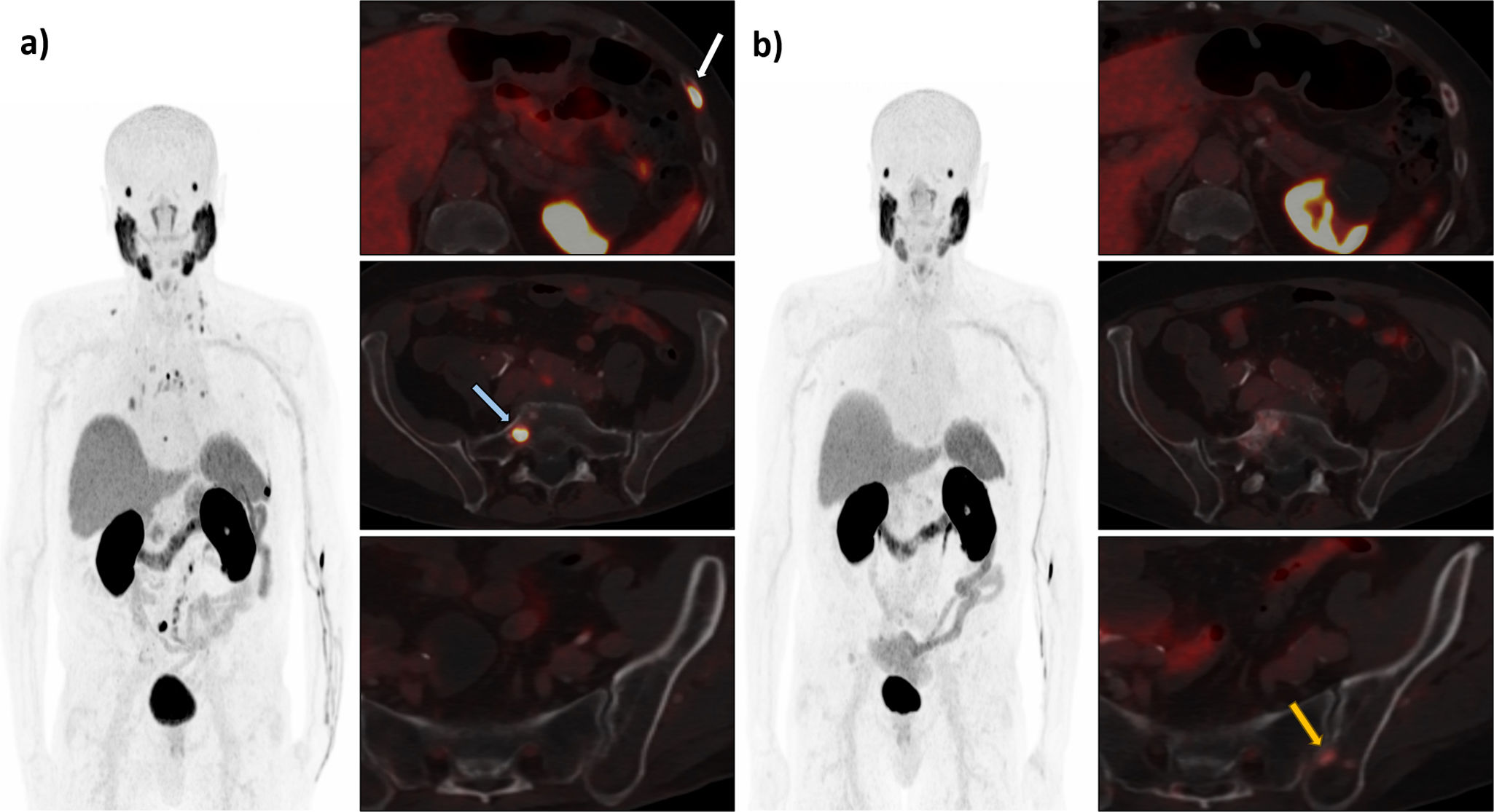 fig0005