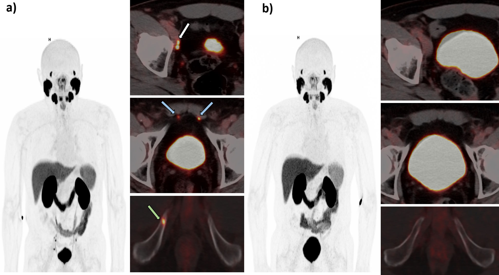 fig0015
