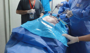 Hernioplastia TAPP en cerdo, ejecutada por un participante orientado por el instructor.