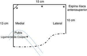 Esquema de corte de malla.