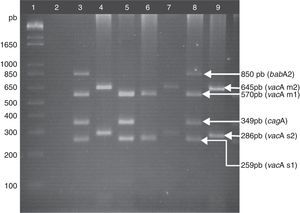 Genotyping of H. pylori. Lane 1: 1kb plus molecular weight marker; lane 2: negative control; lane 3: positive control, DNA from the H. pylori strain J99, vacAs1m1/cagA+/babA2+ genotype; lanes 4, 7, and 9: clinical samples of vacAs2m2/cagA−/babA2− genotype; lane 5: clinical sample of vacAs1m1/cagA+/babA2− genotype; lane 6: clinical sample of vacAs1m1/cagA−/babA2− genotype; lane 8: clinical sample of vacAs1m1/cagA+/babA2+genotype. Agarose gel at 2.5%.
