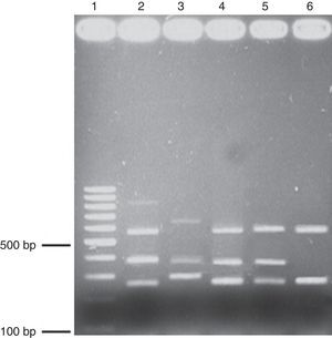 Multiplex PCR. Agarose (1.7%) gel electrophoresis showing the amplicons obtained through multiplex PCR. Lane 1, 100-bp ladder; lane 2, positive control triple virulence strains, lanes 3-6, clinical isolates. babA2 (812bp); vacAs1(259bp); vaAs2(286bp); vacAm1(570bp); vacAm2(645bp); cagA(340bp). The genomic DNA of the H. pylori ATCC 43504 strain was used as a positive control.