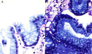Giemsa stain. A and B) Bacilli morphologically compatible with H. pylori.