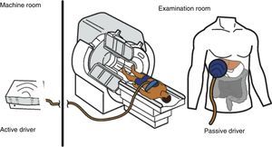 Diagram of the components of the magnetic resonance elastography equipment. The active driver that generates the pulses is in the machine room. The pulses are transmitted in the form of wavelengths through a plastic tube that connects that device with the plate. The plate is a passive driver, 10cm in diameter, that is placed at the liver and it transmits the wavelengths to the organ. The plate is secured to the body with an elastic band.