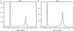 Spectroscopy of lipids. Graphs a and b show 2 main peaks: on the left, an elevated peak that corresponds to water and on the right, a lower peak that corresponds to triglyceride concentration. Note that the triglyceride peak is higher in image b in a patient with a greater lipid concentration.