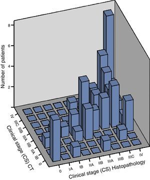 Bar graph representing the greater correlation between the preoperative tomographic staging and the histopathologic results for CS, in which the greater association is observed in CS 0, CS III, and CS IV. Source: direct.