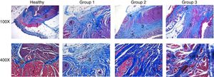 Histopathologic analysis. Histopathologic sections stained with Masson