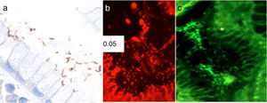 Photomicrographs of gastric mucosa. a) Identification of H. pylori through immunohistochemistry. b) Positive FISH (resistant H. pylori strain): presence of resistance to clarithromycin mutations (red dots). c) Negative FISH (sensitive H. pylori strain): no resistance to clarithromycin mutations.