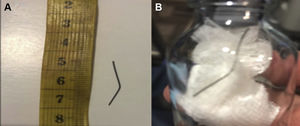 A and B: Wire bristle from a grill brush.
