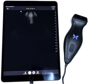 Pocket-sized ultrasound equipment.