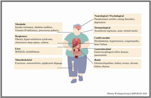 Complications and comorbidities associated with overweight and obesity in children and adolescents. MASLD: metabolic dysfunction-associated steatotic liver disease.