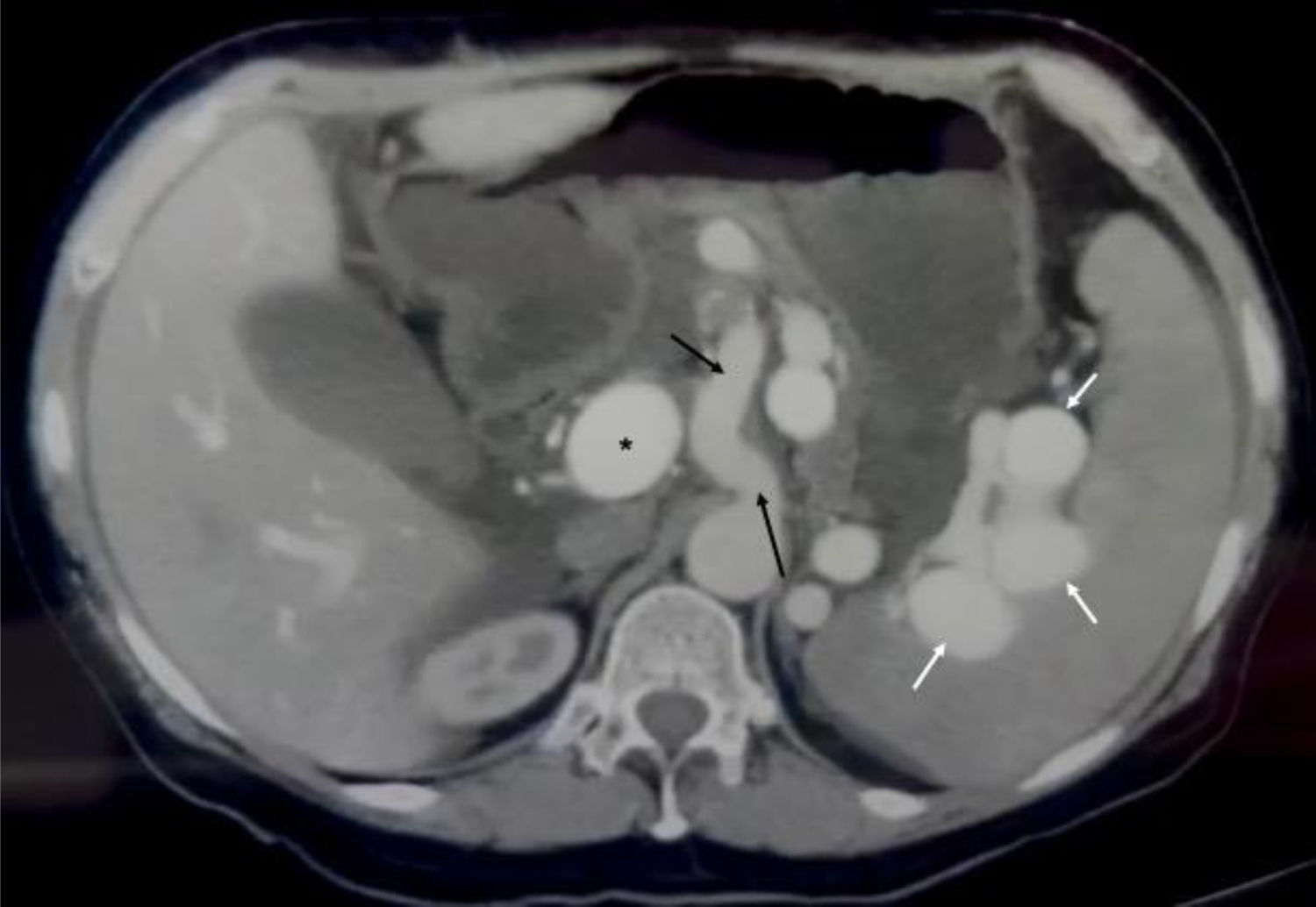 fig0005