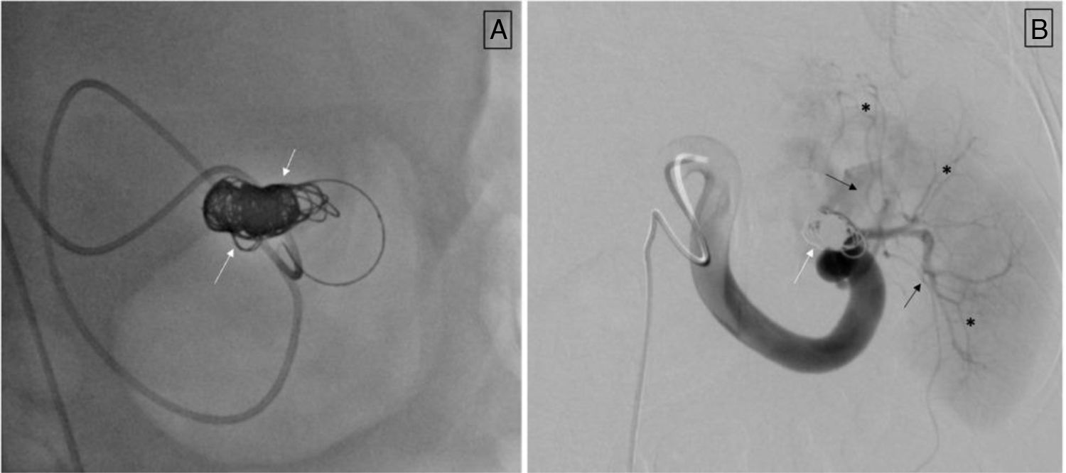 fig0015