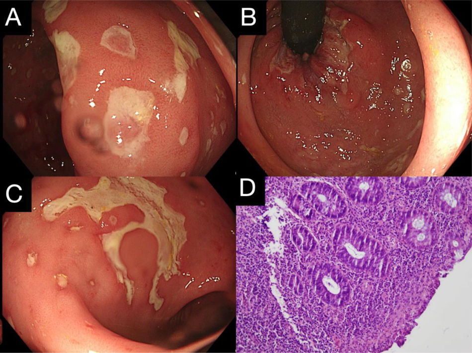 fig0005