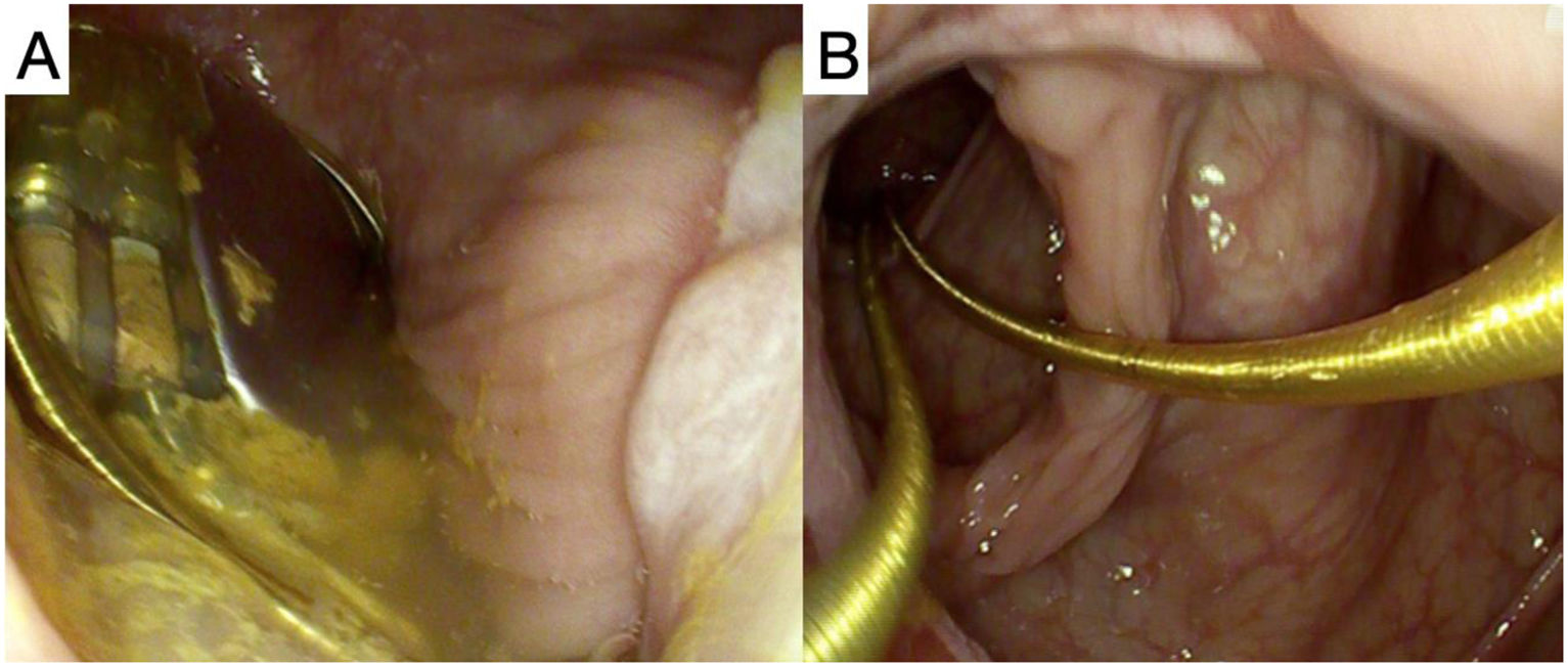 fig0010