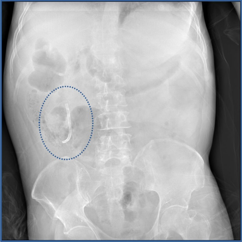 fig0005