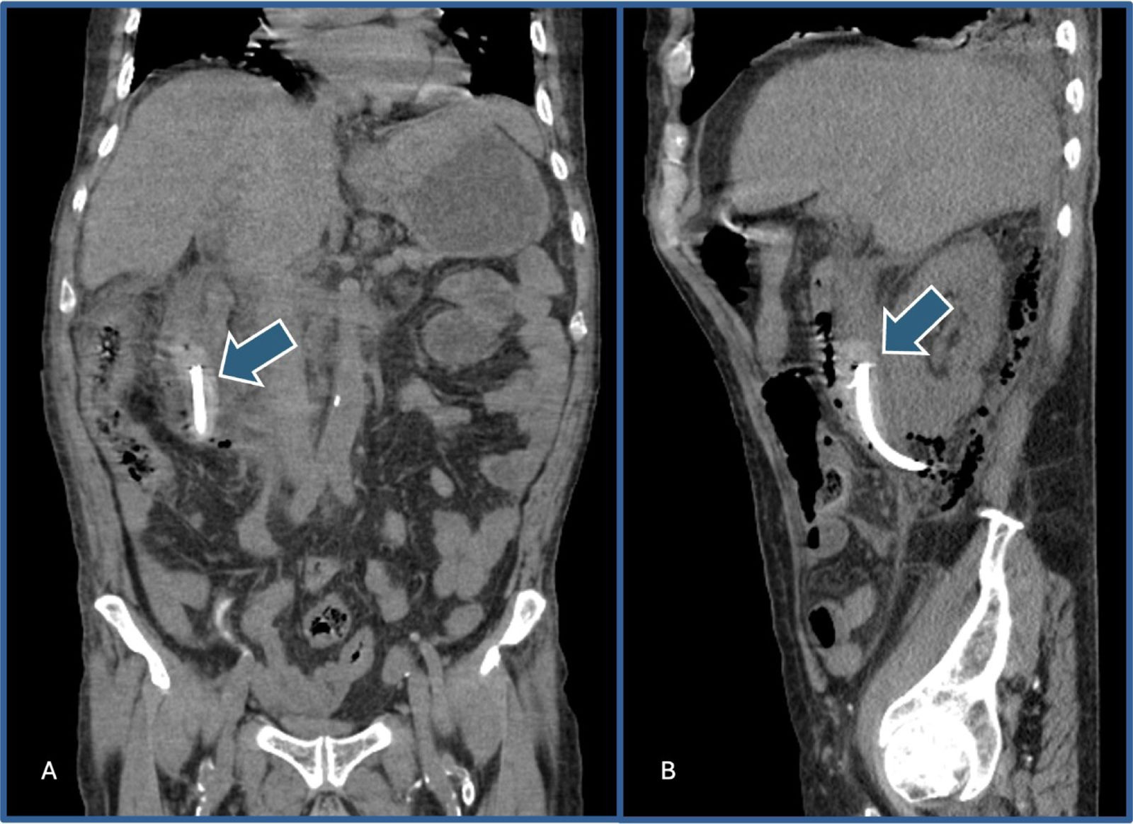 fig0015