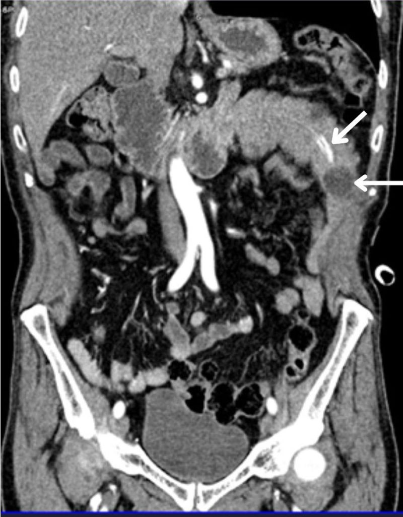 fig0010